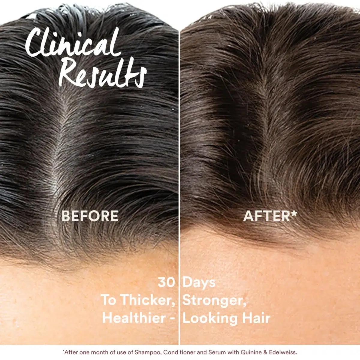 Klorane Anti-Hair Loss Serum 100ml – Image 5