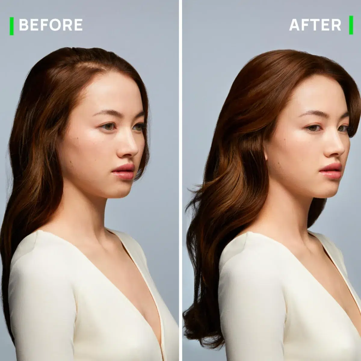 René Furterer Triphasic Progressive Anti Hair Loss Serum 8x5.5ml – Image 7