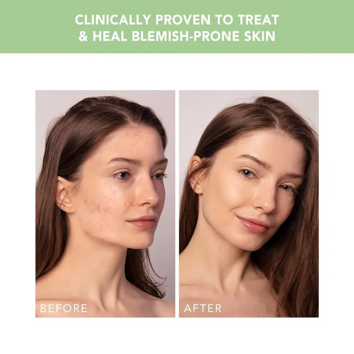 FOREO ESPADA™ 2 Plus Pistachio – Image 3